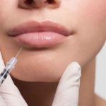 7 Benefits Of Lip Fillers in Dublin