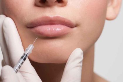 7 Benefits Of Lip Fillers in Dublin