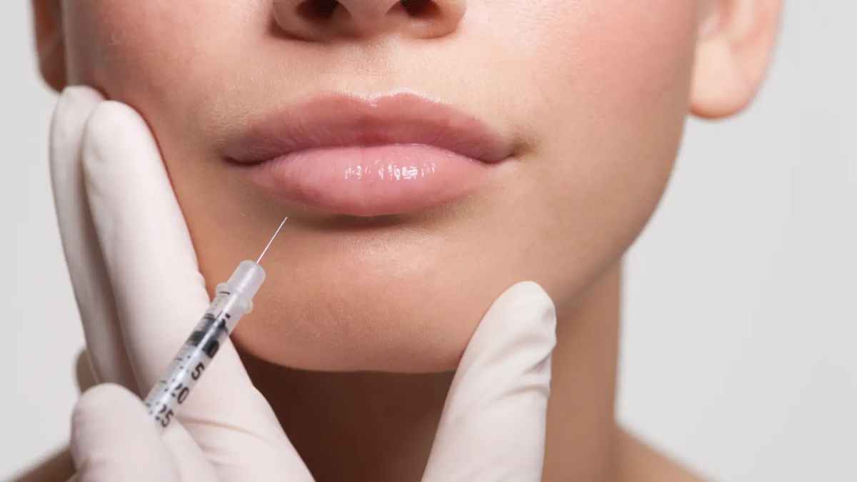 7 Benefits Of Lip Fillers in Dublin Readability