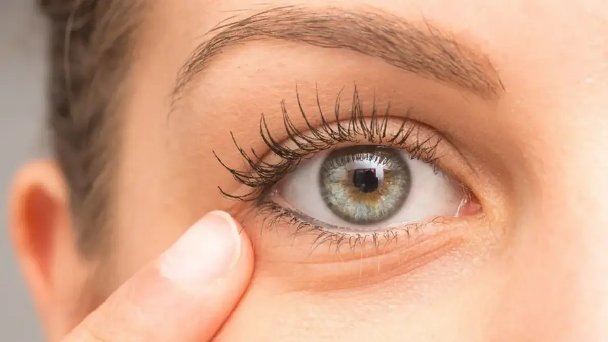 Best PDRN Skin Booster Dark Circle and Eye Bag Treatment Readability