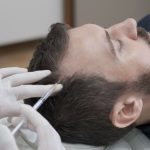 Understanding PRP Hair Loss Treatment How Platelet-Rich Plasma Therapy Works