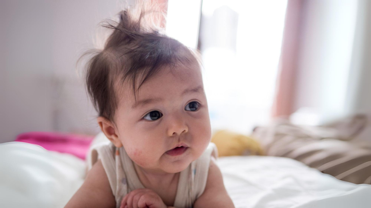 Beyond the Scratch: A Parent's Guide to Managing Baby Eczema - Readability