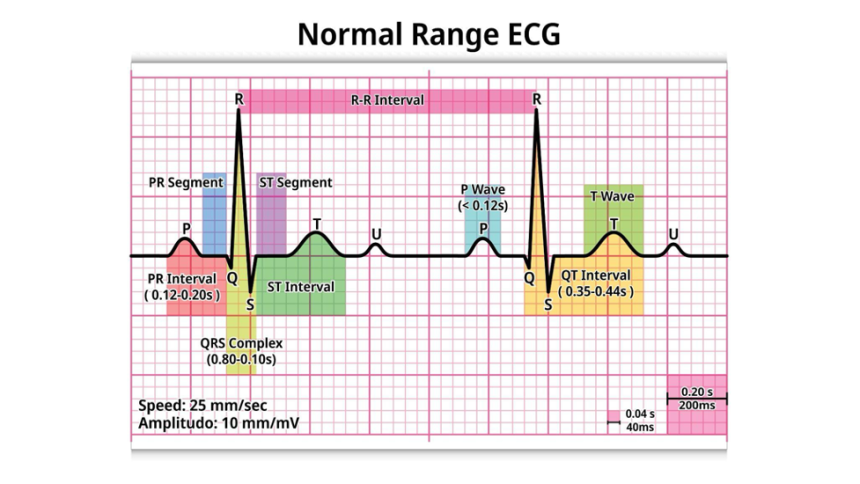 How To Make a DIY Electrocardiogram (ECG) Machine - Readability