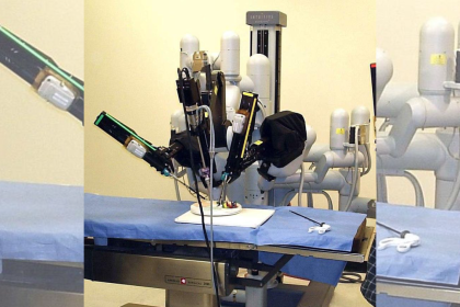 What Is Robotic Surgery and How Does It Compare to Traditional Surgery