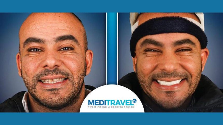 The Rise of Polish Medical Tourism to Turkey Hollywood Smiles and Hair Transplants Redefined