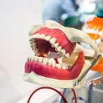 Comfortable dentures, natural-looking smile