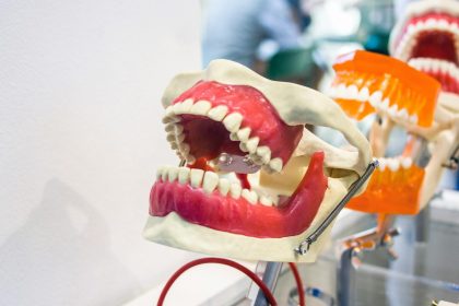 Comfortable dentures, natural-looking smile