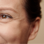 Botox for More Than Wrinkles A Breakthrough for Migraine Relief
