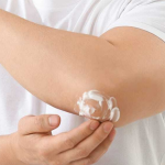 How I Handled My Itchy Skin Rash With a Minimum of Fuss