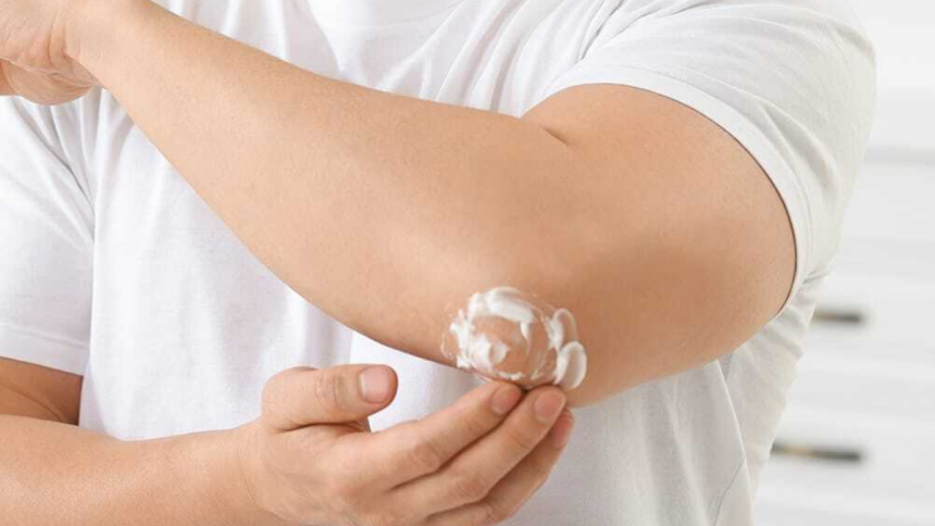 How I Handled My Itchy Skin Rash With a Minimum of Fuss