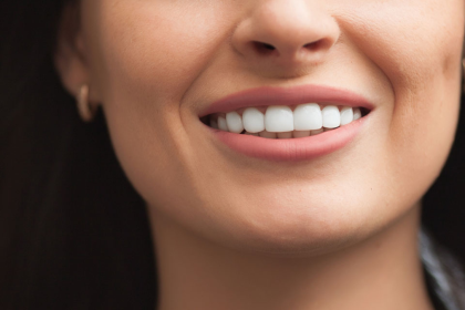 From 3D Scans to Same-Day Crowns The Tech Advantage in Cancun Dentistry