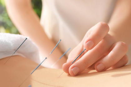 Restoring Fertility Naturally How Acupuncture and TCM Create Optimal Conditions for Conception