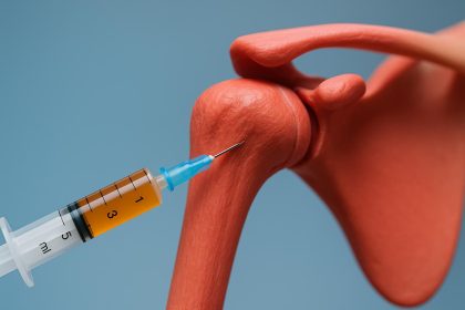 PRP therapy injection for shoulder recovery at a medical clinic in San Diego