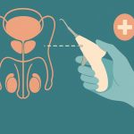 Modern vasectomy tools and painless procedure preparation in a clinical healthcare setting