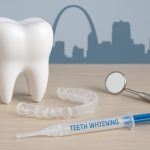 Bright white teeth with whitening trays and dental tools highlighting teeth whitening benefits.