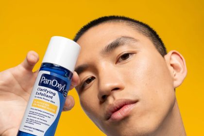 5 Things to Know About the Best Acne Treatment for Teens