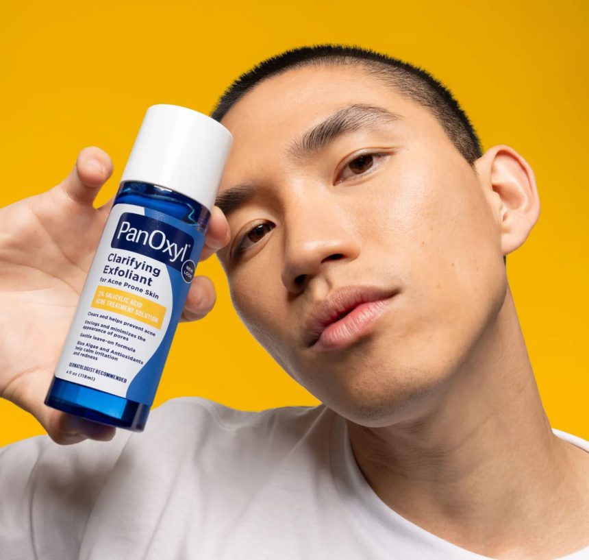 5 Things to Know About the Best Acne Treatment for Teens