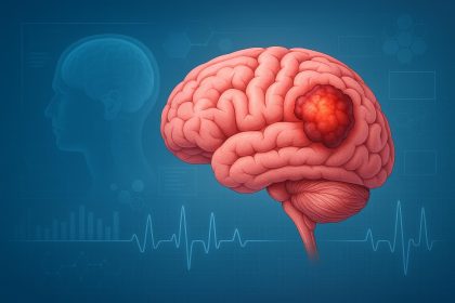 Advanced astrocytoma treatment methods and modern brain tumor care approaches in healthcare