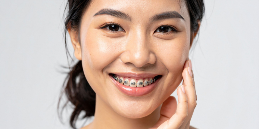 Image 1 of How to Know If You Need Braces: Signs You Shouldn’t Ignore