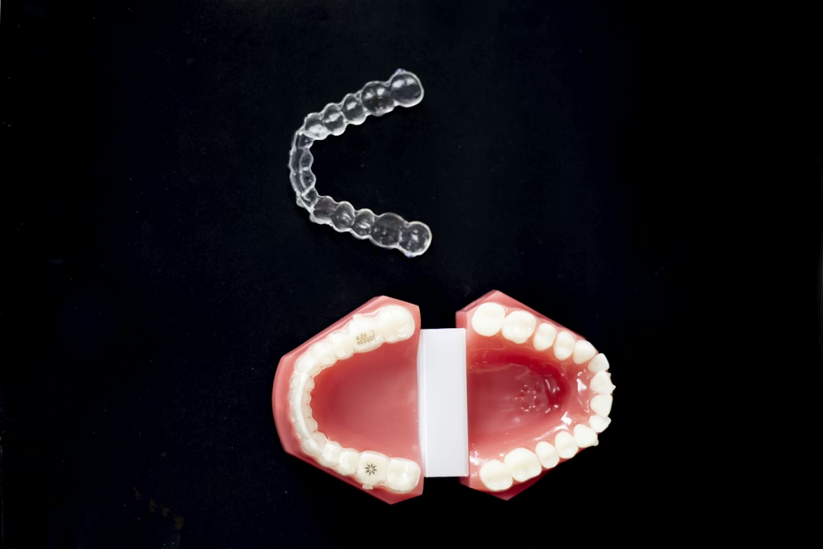 Clear Aligner Treatment Explained as a Modern Approach to Straighter ...