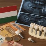 Dental implants, Hungarian clinic exterior, dental chairs, and full-mouth treatment options